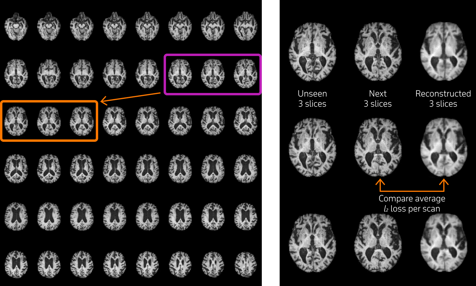 Example of unsupervised medical anomaly detection